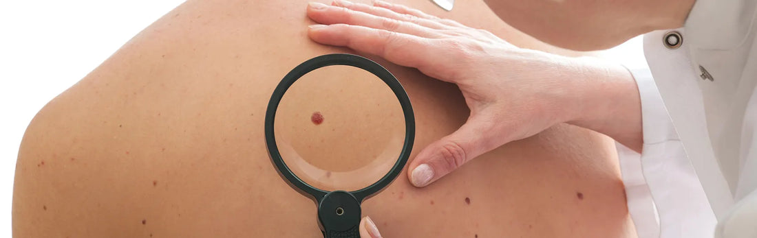 article-page-carousel-item--NAD+ Reduces Mutations and Incidence of Skin Cancer