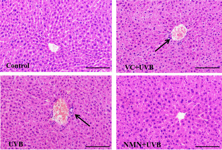 article-page-carousel-item--NMN Injection Protects Against UV Damage to Skin